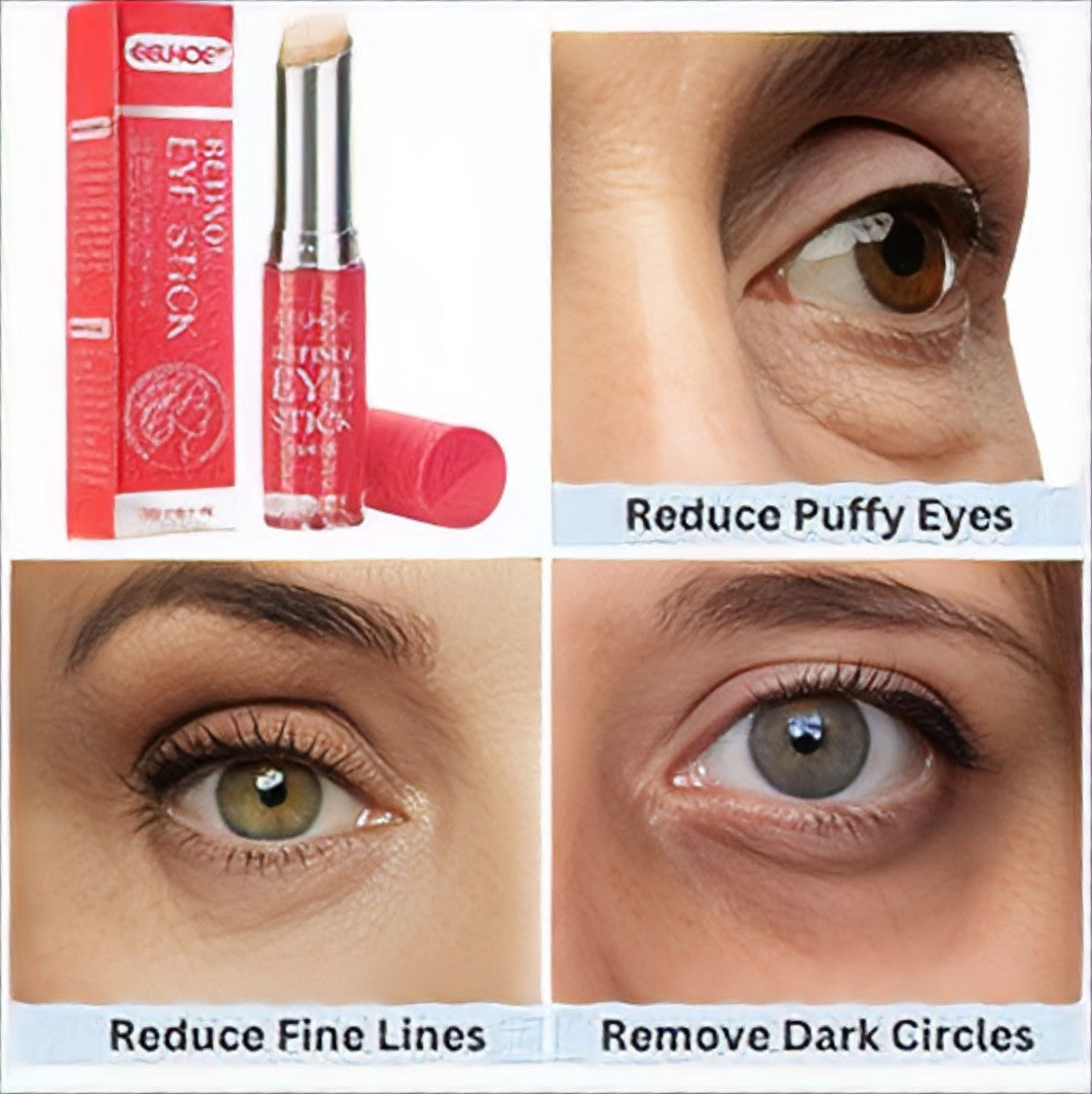 Youthful Eyes Retinol Stick